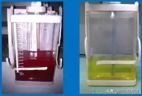 肺癌胸水控制了说明好转了吗,有胸水了还可能是早期肺癌吗