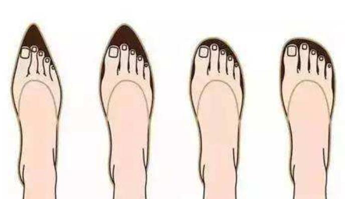 穿鞋脚痛的问题,如何解决穿鞋脚痛