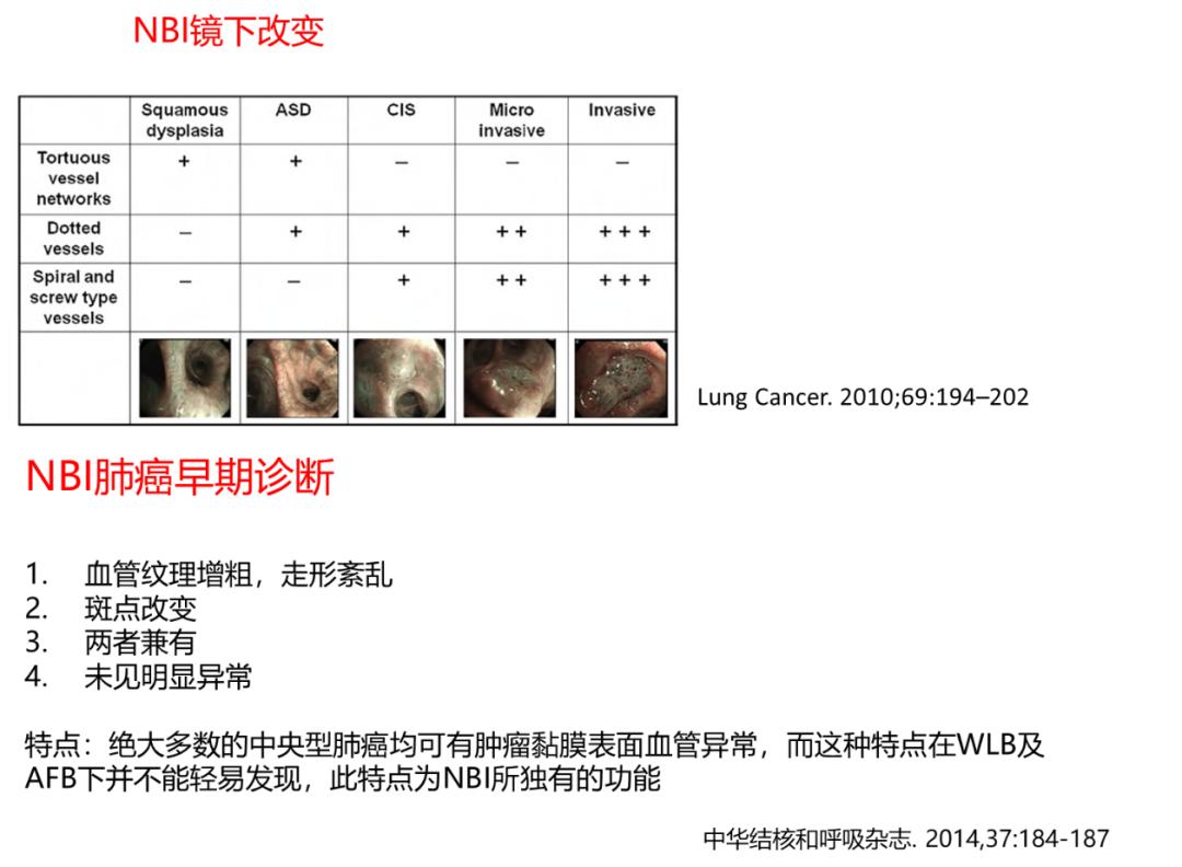 孙加源门诊,治疗肺癌的新技术新手段