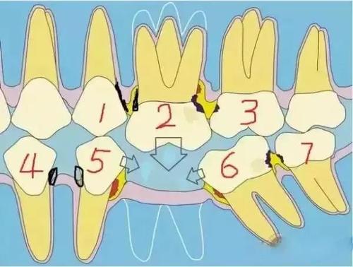 假牙制作纯手工,假牙新材料制作方法