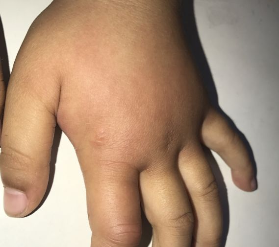 宝宝出去防蚊子叮咬的最佳方法,宝宝一直被蚊子咬怎么驱蚊