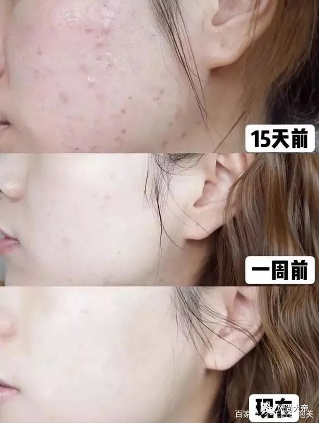 洗面奶贵一点推荐,洗面奶排行榜第一名适合干性肌肤