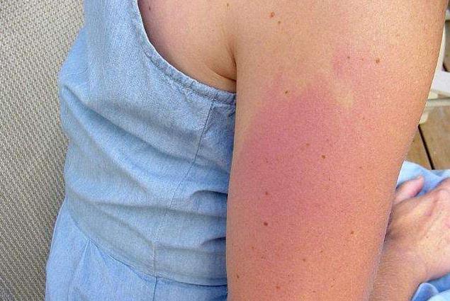 炎炎夏日，手臂已黑白分明？快给它也穿上“空调”凉快一下