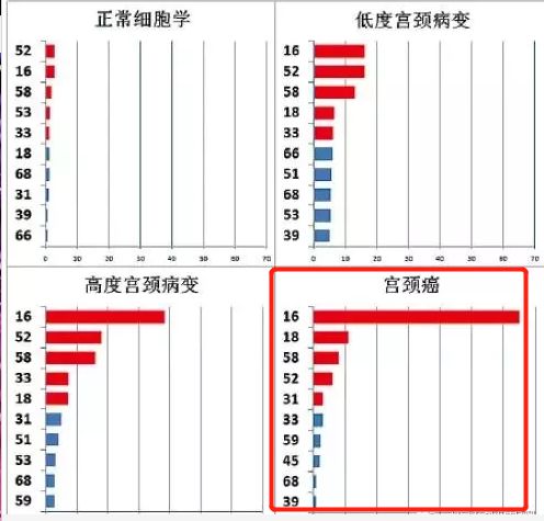 没有症状患宫颈癌的概率大吗,没症状会得宫颈病吗