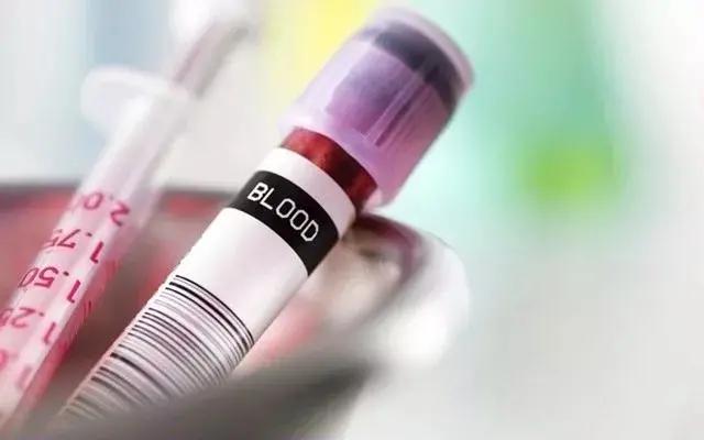 试管为什么要每天打针,试管为啥要2天抽一次血