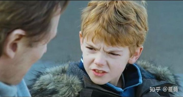 植发多年以后非植发区掉光,植发以后还可以植发吗