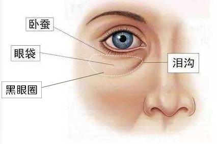 脾胃虚弱会导致眼袋肿吗,脾虚眼睛红肿眼袋发黑