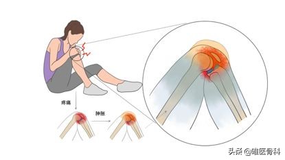 3分钟了解膝盖,3分钟了解你的膝盖并仔细观看