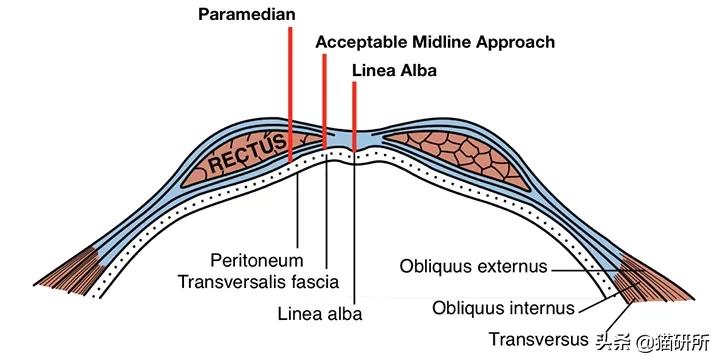 猫咪绝育正切好还是侧切好,猫咪绝育手术局麻好还是全麻好