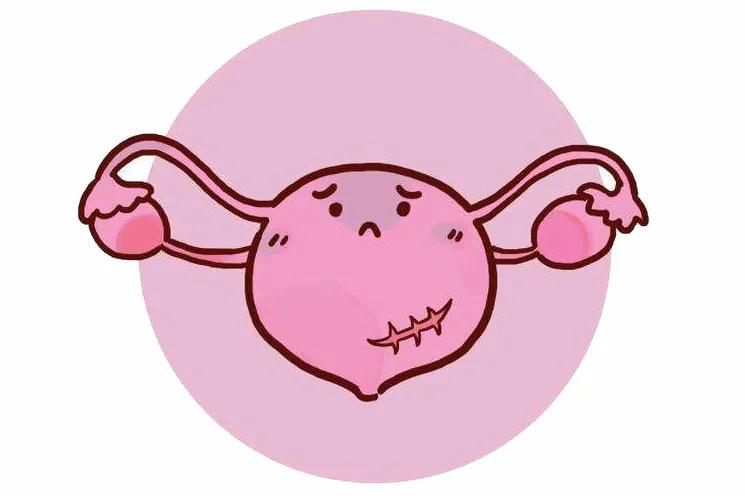 剖腹产宝宝历险记,高龄产妇生娃历险记