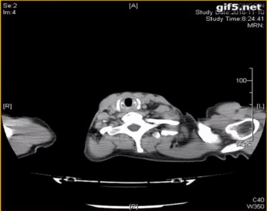 仓静简历,中山医院麻醉科主任仓静