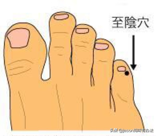 胎儿臀位,在孕多少周之前算是正常现象?巧用这3种方式扭转胎位