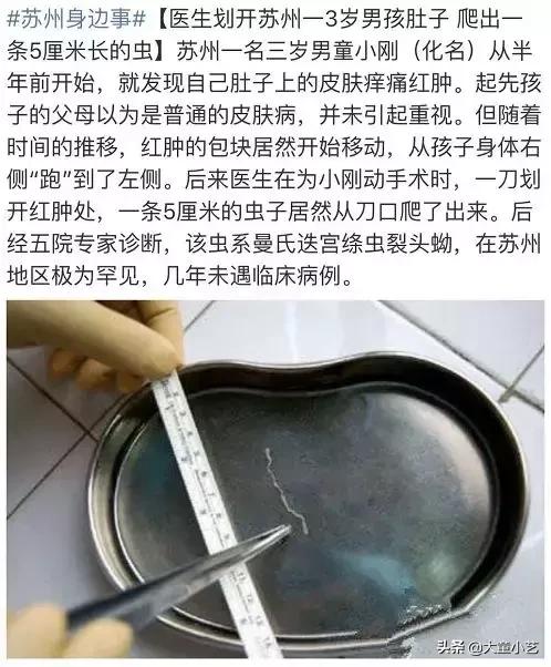 3岁男童肚子有虫怎么办,3岁男孩肚子里有虫子