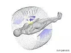 放疗真的会死得更快吗,放疗真的很痛苦吗