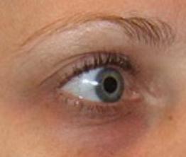 在人人爱美的时代，黑眼圈很重怎么办？缓解黑眼圈的有效办法推荐