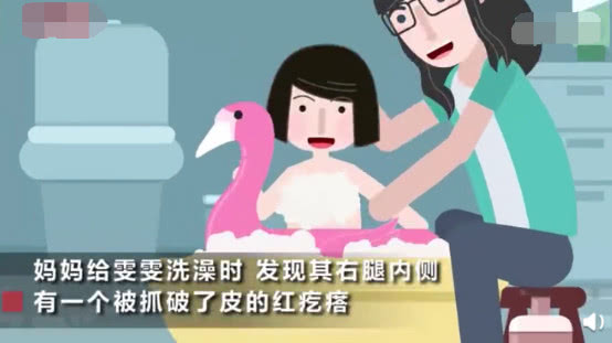 女童被蚊虫叮咬,女童被蚊子咬了肿好大怎么处理