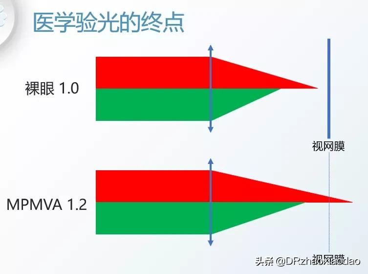 视力1.0+正常吗,视力1.0+能降低眼睛度数吗