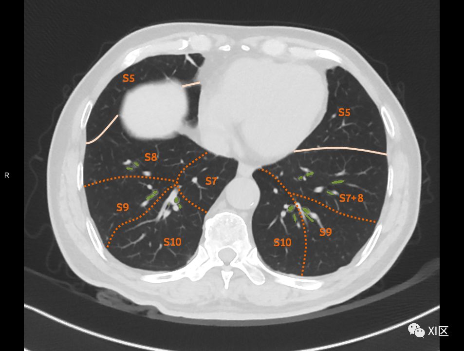 如此详细的肺部影像解剖，有点儿酷！