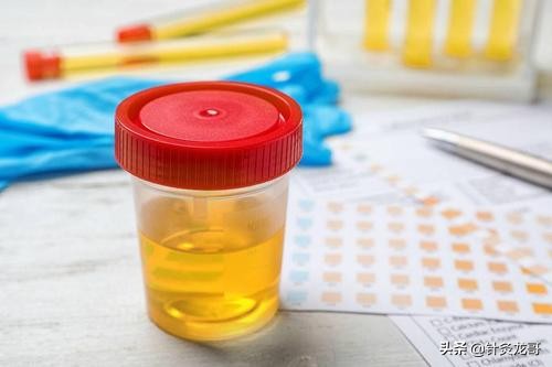 你每天撒的尿有你不知道的秘密