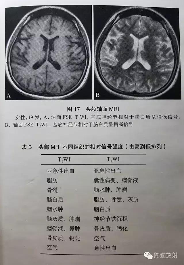mri中t1wi和t2wi有什么区别,mri中t1w1与t2w1区别