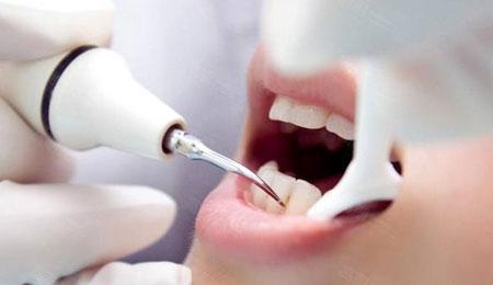 南宁牙齿矫正的每一个详细步骤,地包天牙齿矫正步骤和器材