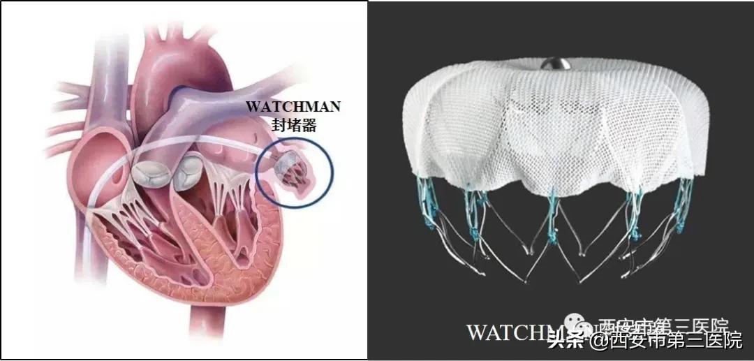 小心眼小妙招,改掉小心眼的小妙招