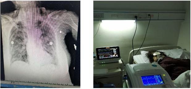 呼吸科陈荣昌,陈荣昌医学专家