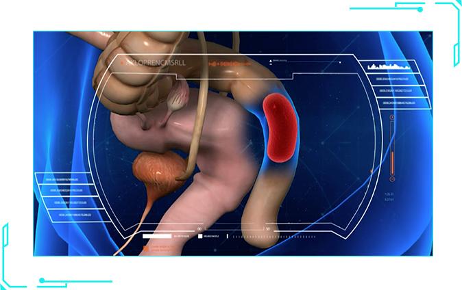 夫妻X生活不和谐暗藏的盆底肌松弛危机