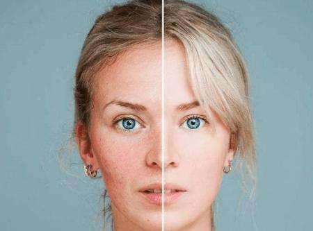 抹化妆品过敏什么症状,化妆品过敏有哪些症状