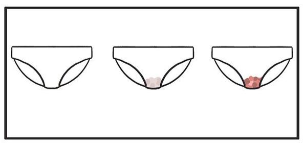 白带黄绿色医院却说没事,白带是褐色就是得病了吗