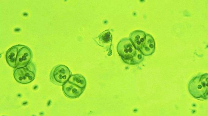 无性生殖到有性生殖的进化,无性生殖是怎么进化成有性生殖的