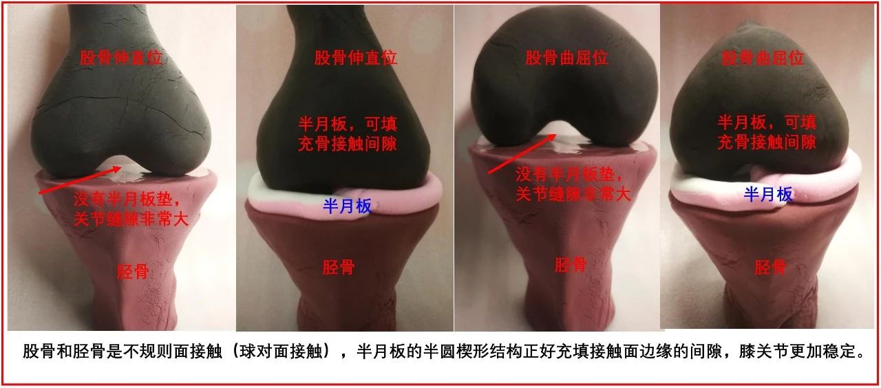 善待你的半月板,善待膝关节珍惜半月板