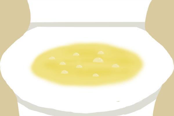 小便有股咸鸭蛋的味道是怎么回事,小便有股烧焦的味道