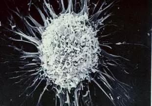 真菌毒素检测仪检测黄曲霉毒素,黄曲霉毒素用elisa检测