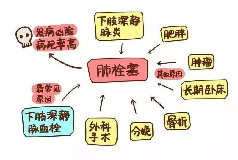 肺动脉栓塞的抢救视频,肺动脉主干栓塞