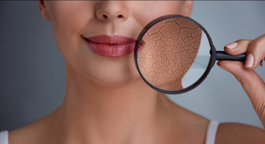 嘴唇干燥综合症怎么治,干燥综合征容易出现哪些口腔症状