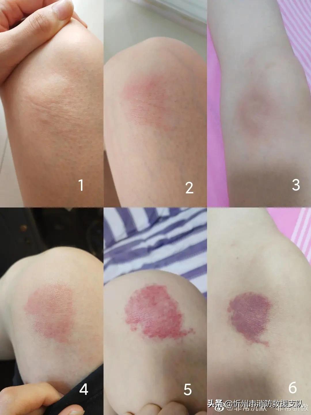 食人蚁袭击人类,一口气看完食人蚁袭击人类