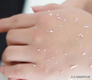 手部皮肤粗糙是缺什么,手部蜡黄暗沉