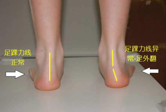 买跑鞋应该怎么买,买跑鞋怎么选择尺码