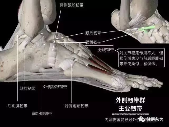 国家队康复师崴脚,国家队运动员扭伤用什么药