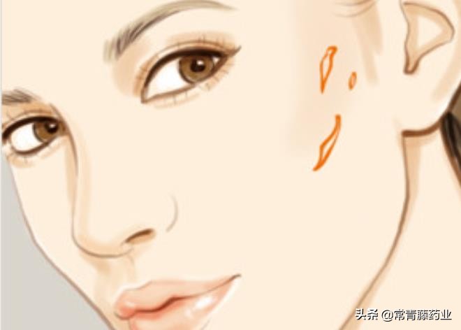 爱美之心,人皆有之,瘢痕的这些事是你想要知道的吗?