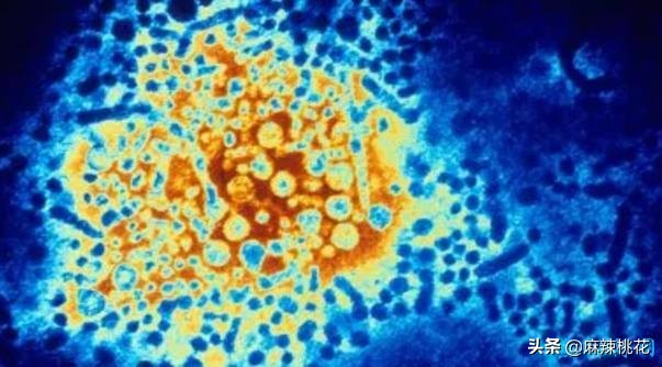 最危险的10种致命病毒,世界最难治病毒