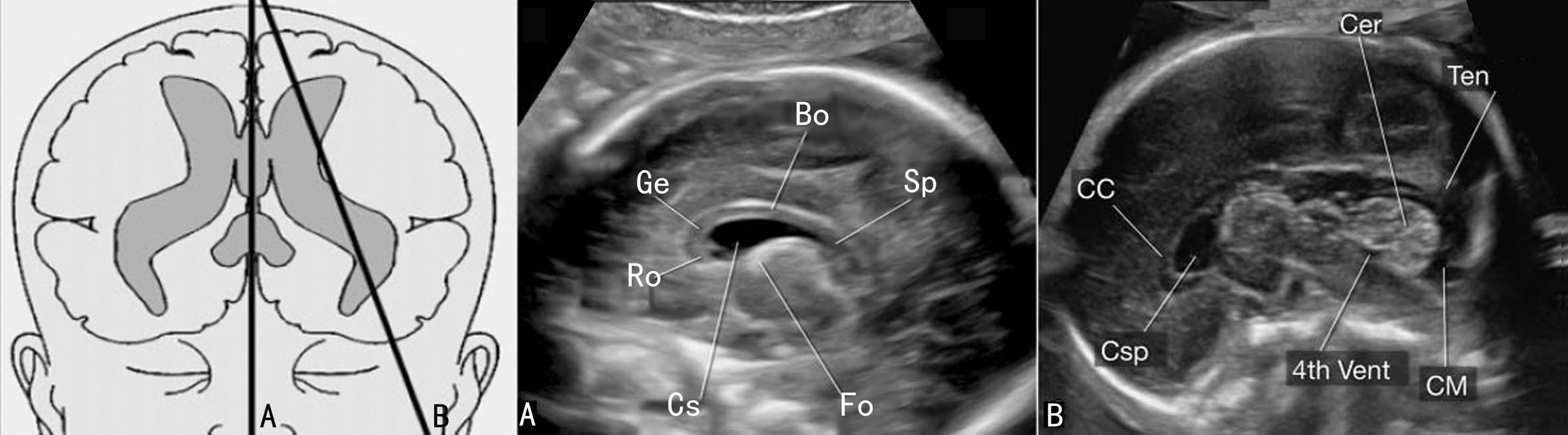 做彩超是不是能清楚看见胎儿,做彩超胎儿仰面平躺