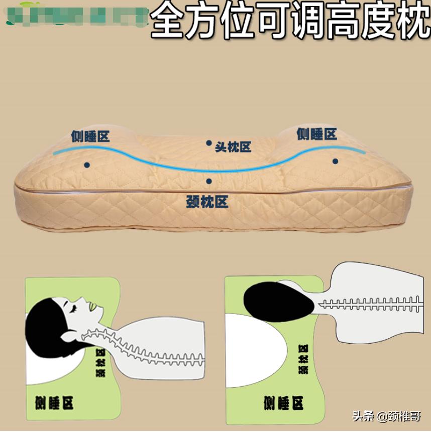 颈椎生理曲度反弓可以去健身房吗,颈椎病反弓原理