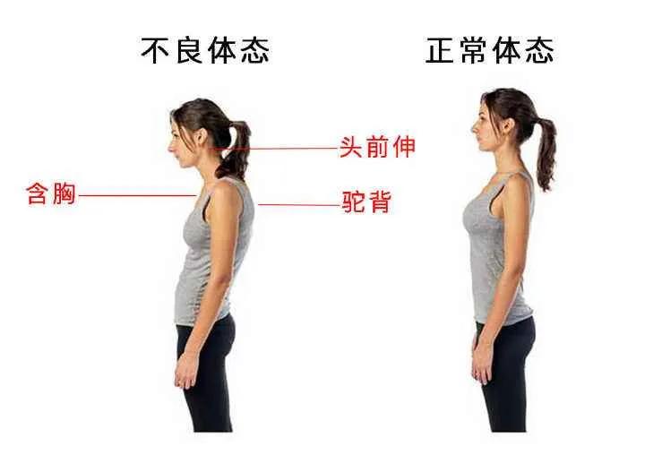 产后含胸驼背能纠正吗,产后脖子后背发凉不舒服怎么办