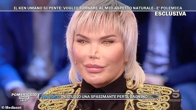 “真人肯尼”痴迷整容多年后，最终将自己整成了女人