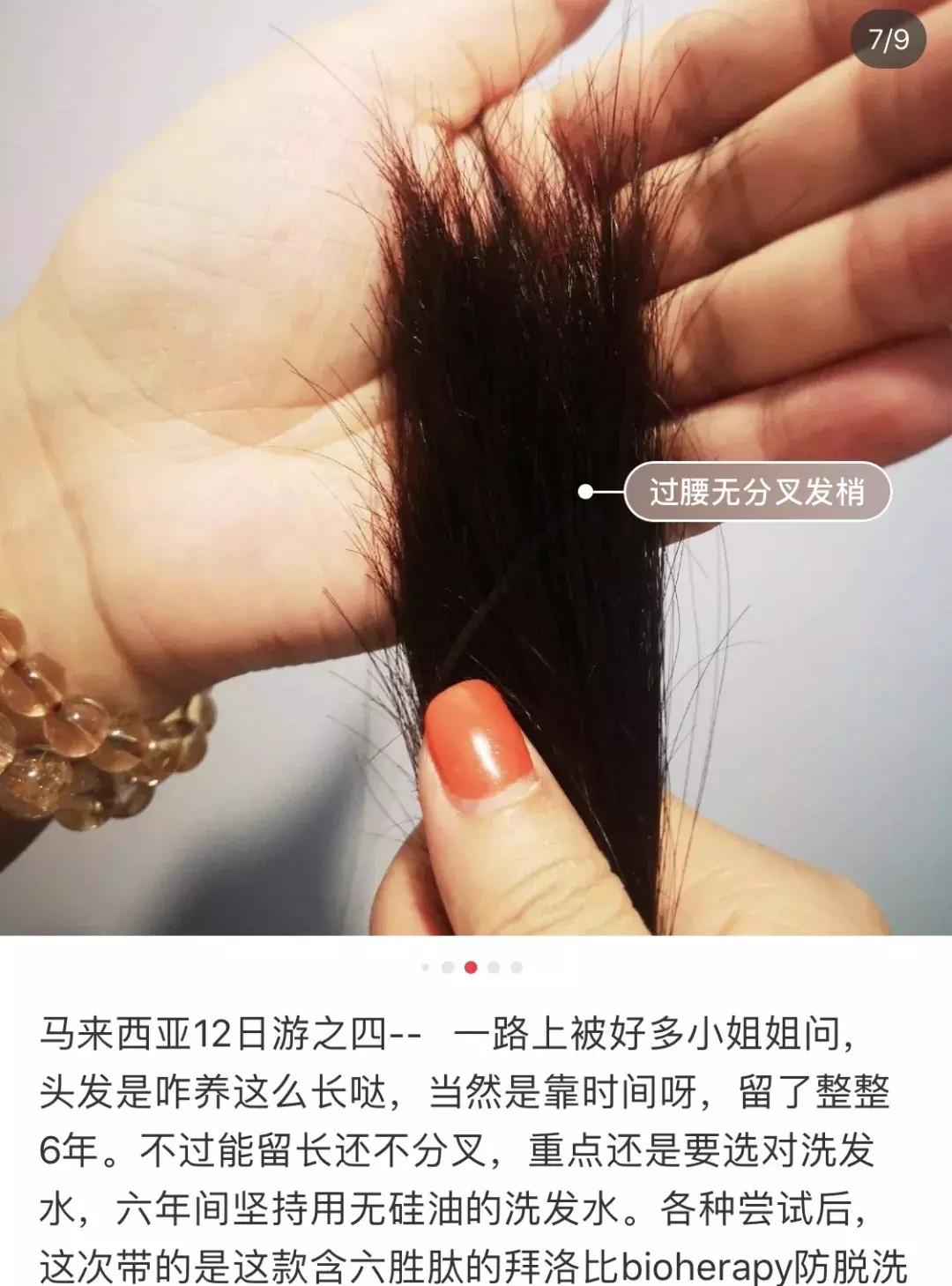 头发毛躁并且脱发推荐洗发水,用什么洗发水改善头皮脱发