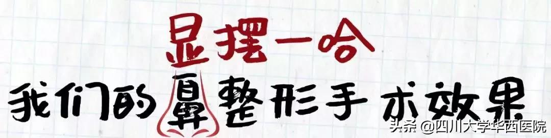 鼻子太翘怎么整形,鼻子太尖整形修复最佳方法