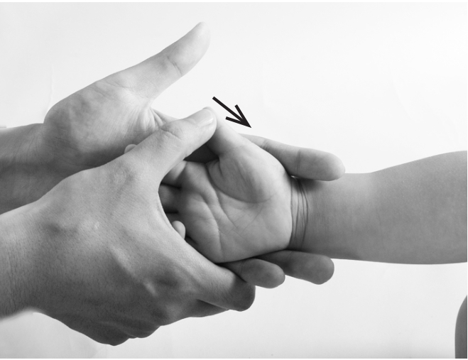 儿童扁桃体肥大最简单的偏方,小儿扁桃体肥大反复发炎怎么办