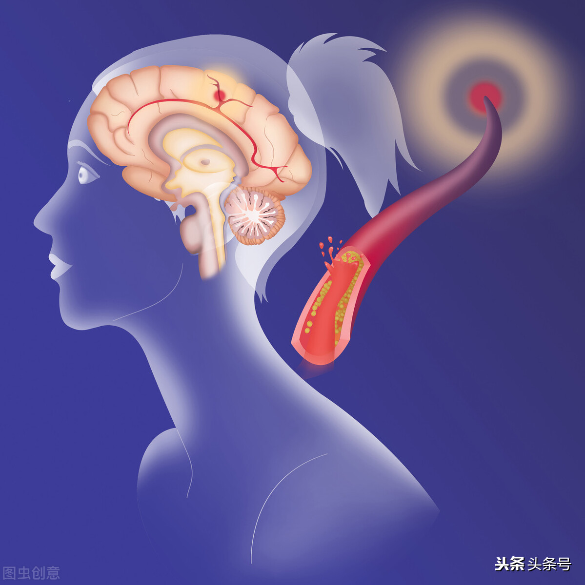 器质性精神障碍症是怎样引起的,什么是精神障碍性疾病